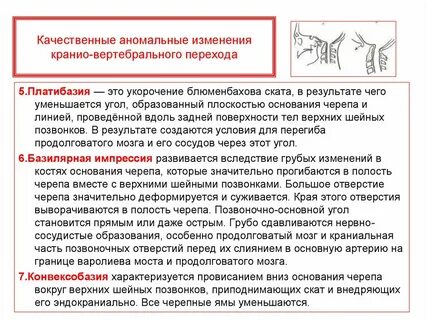 Аномалия изменения