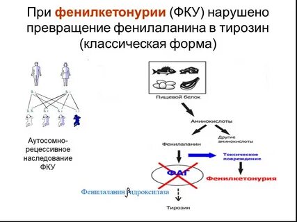 Фенилкетонурия наследуется по