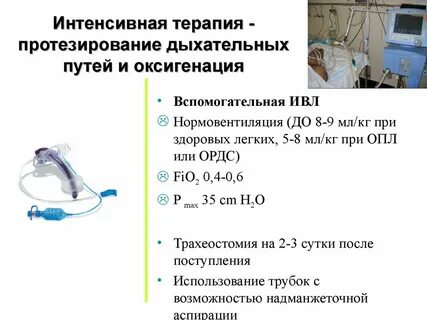 Сколько находится на ивл