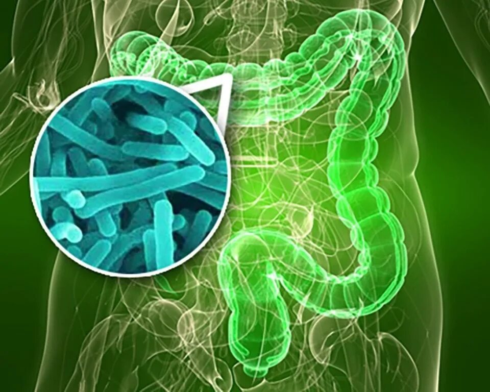 Дисбактериоз микрофлоры кишечника. Бактерии микробиота кишечника. Микробиота кишечника человека. Микробиом (микробиота). Хорошие и плохие бактерии в кишечнике.