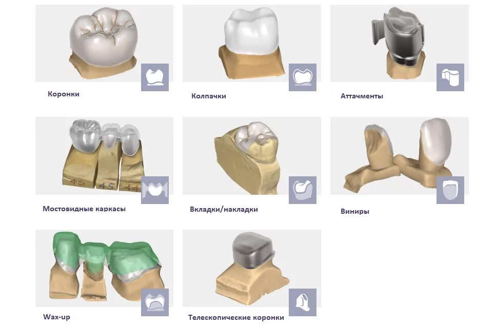 Какого функционала нет в cad cam системах. Exocad коронка. cad cam коронки. телескопические коронки фиксация. моделировка в программе exocad.