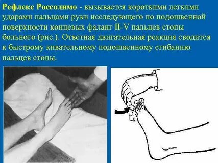 Рефлекс пальцев