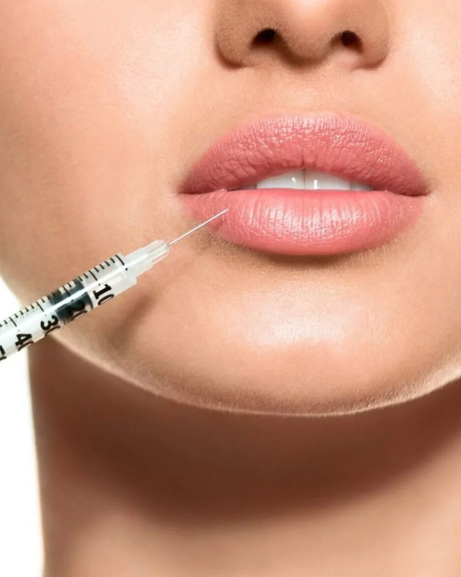 Контурная пластика губ гиалуроновой. Контурная пластика. Контурная пластика. Инъекция ботокса в губы. Инъекция ботокса в губы.