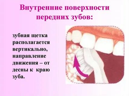 К чему снится десна