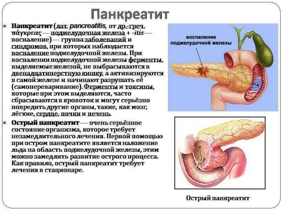 Панкреатин болезнь симптомы и причины. Болезнь хронический панкреатит поджелудочной железы. панкреатин болезнь поджелудочной железы. симптомы панкреатита поджелудочной железы. панкреатит это заболевание поджелудочной железы.