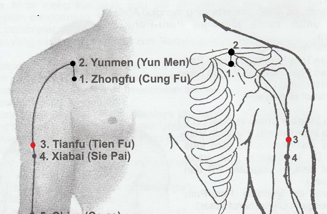 Точка ужасно. Акупунктурная точка Чжун фу. Точка Чжун фу расположение. Точка p1 акупунктура. Юнь Мэнь точка.