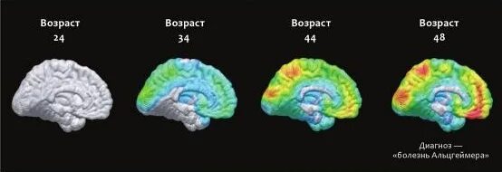 Тест альцгеймера сколько лиц на картинке. Картина для проверки Альцгеймера. Задания для Альцгеймера. Задачи Альцгеймера с ответами. Лучшие тесты на Альцгеймера.