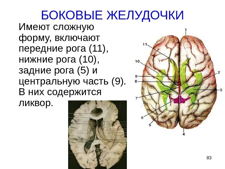 Анатомия Нижнего рога бокового желудочка. Функции затылочный Рог бокового желудочка. Нижний Рог бокового желудочка. Расширение заднего рога бокового желудочка головного мозга. Затылочные рога