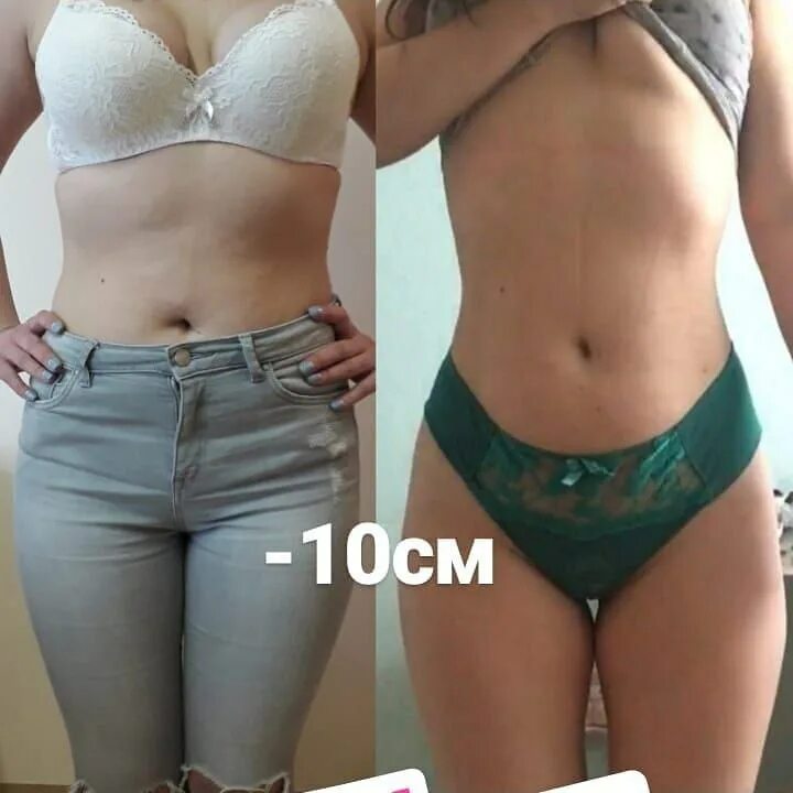 Талия по методу кудзаева. Уменьшение талии операция. Сужение талии. Уменьшение талии по методу кудзаева. Ребра кудзаева.