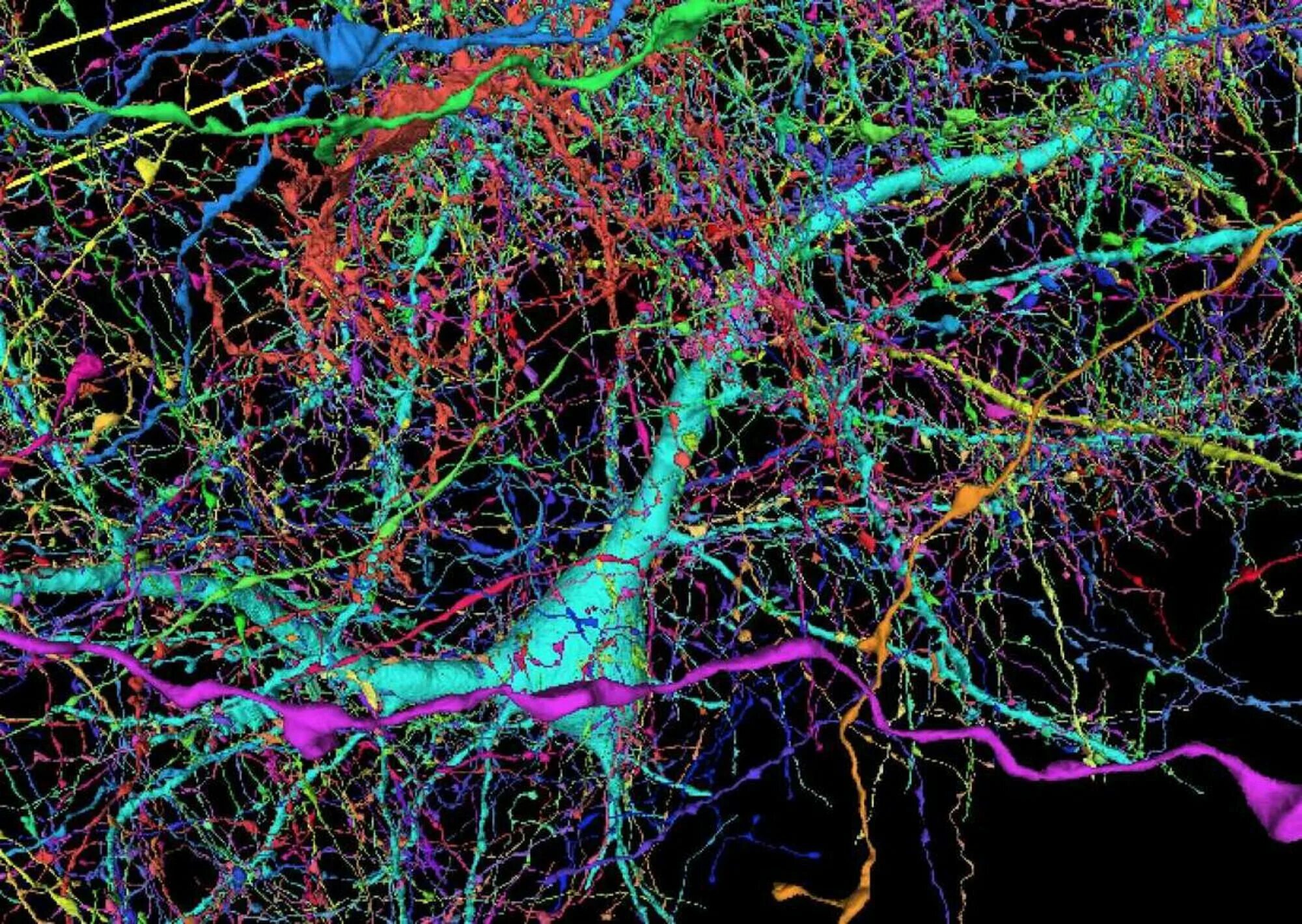 Связи между нейронами головного мозга. Нейронные сети головного мозга ребенка. Нейронная сеть головного мозга человека фото.