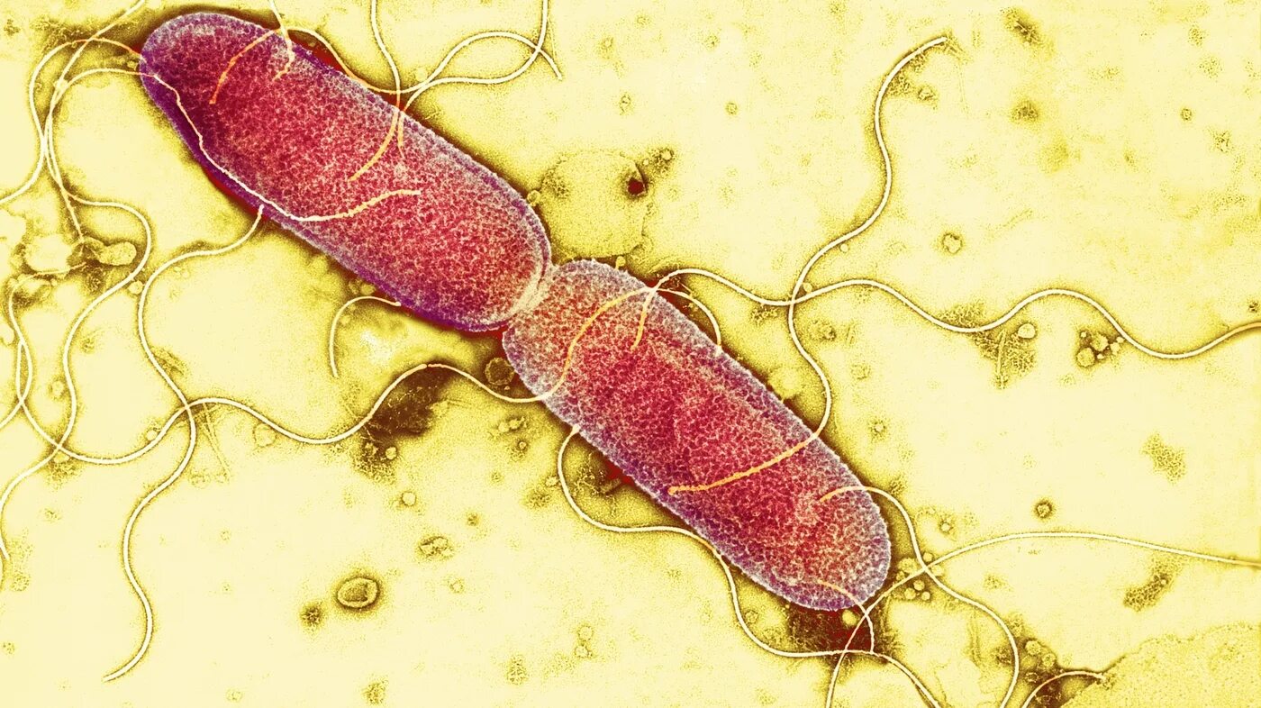 Микроорганизмы. Бактерии картинки. Сальмонелла энтерика. Сальмонелла под микроскопом. Salmonella enterica