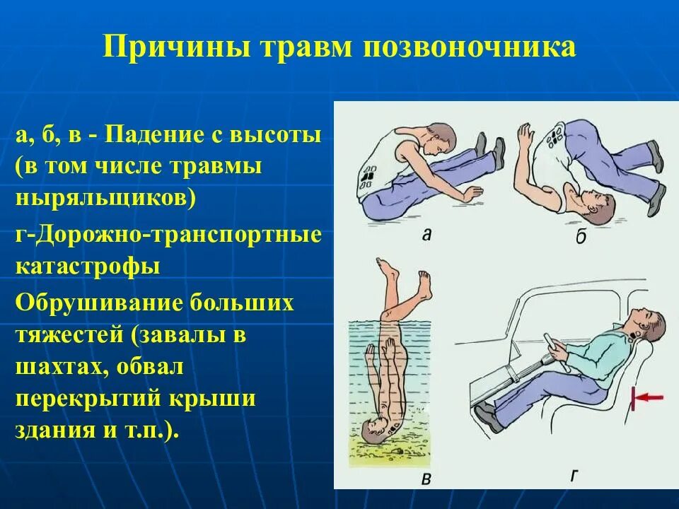 Повреждение позвоночника необходимо. Причины перелома позвоночника. Компрессионный перелом позвоночника т11. Поврежденияпозвоночник.