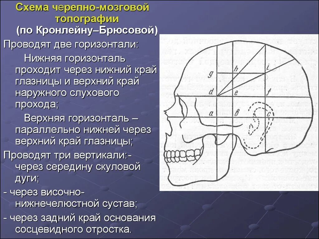 Черепно мозговая топография кренлейна брюсовой. Проекция средней менингеальной артерии по схеме кренлейна. Схема кренлейна-брюсовой. Схема кренлейна-брюсовой. Схема кренлейна-брюсовой.