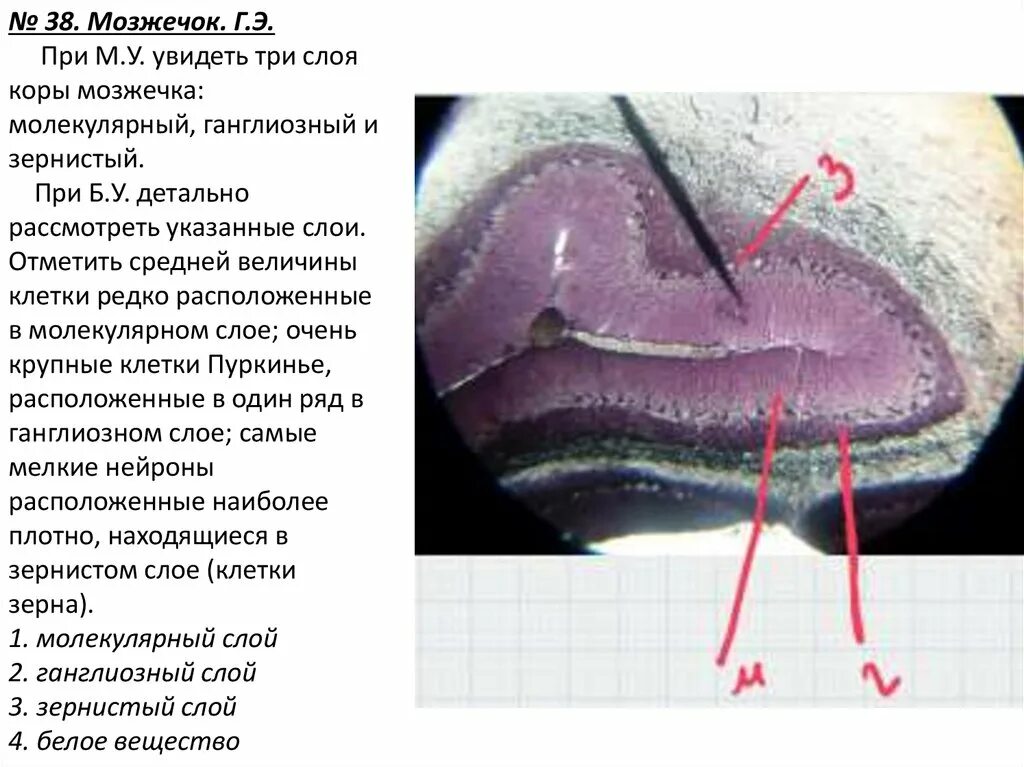 Ткань мозжечка. Мозжечок гистология препарат. Мозжечок собаки гистология препарат. Молекулярный слой коры мозжечка.