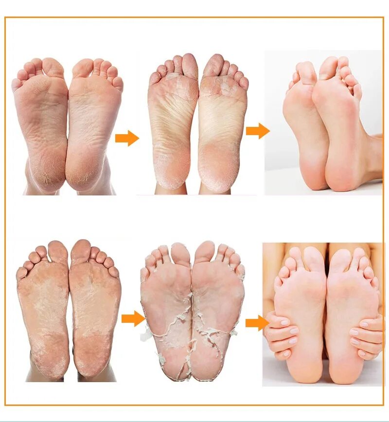 Чистые пятки. Пилинг стоп. Пилинг стоп. Спа-педикюр. Красивые ступни.