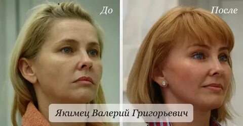 Пластический хирург валерии