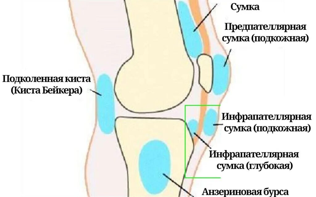 Как лечить гусиную лапку