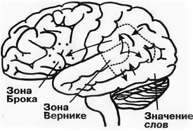 Речевые центры брока и вернике. Зона брока и вернике. Зона брока полушарие. Локализация центров речи. Речевые зоны мозга брока и вернике.