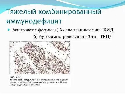 Тяжелая иммунная недостаточность