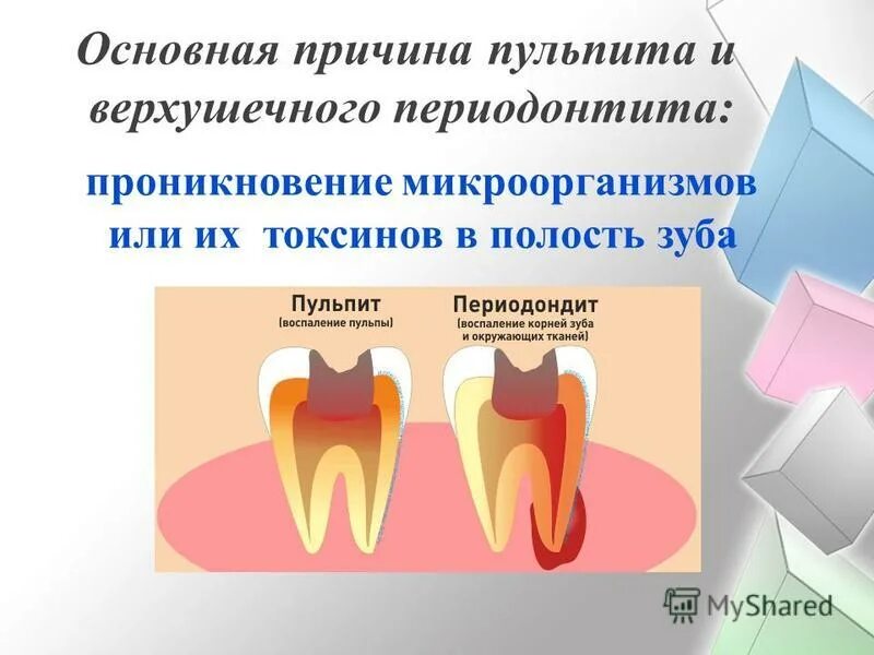 Пульпит тесты с ответами. Апикальный периодонтит классификация. классификация периодонтитов. острый апикальный периодонтит пульпарного происхождения. классификация кариес пульпит периодонтит.