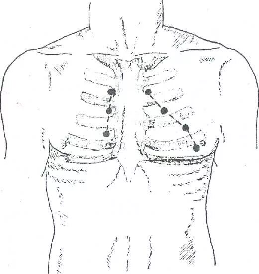 Конфигурация сердца перкуссия. Перкуссия сердца пропедевтика. Перкуссия сердца пропедевтика. Перкуссия сердца пропедевтика алгоритм. Перкуссия сердца пропедевтика алгоритм.