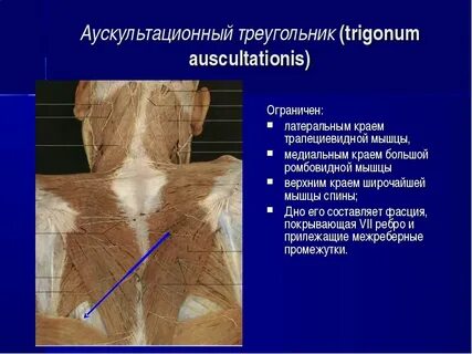 Укажите анатомическое образование