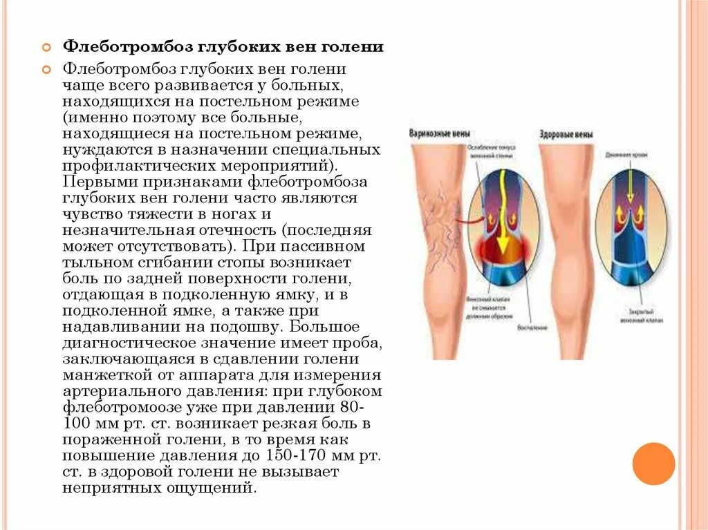 Флеботромбоз бедренно подколенного сегмента. Острый флеботромбоз голени симптомы. Клинические признаки глубокого флеботромбоза конечности. Флеботромбоз глубоких вен голени.