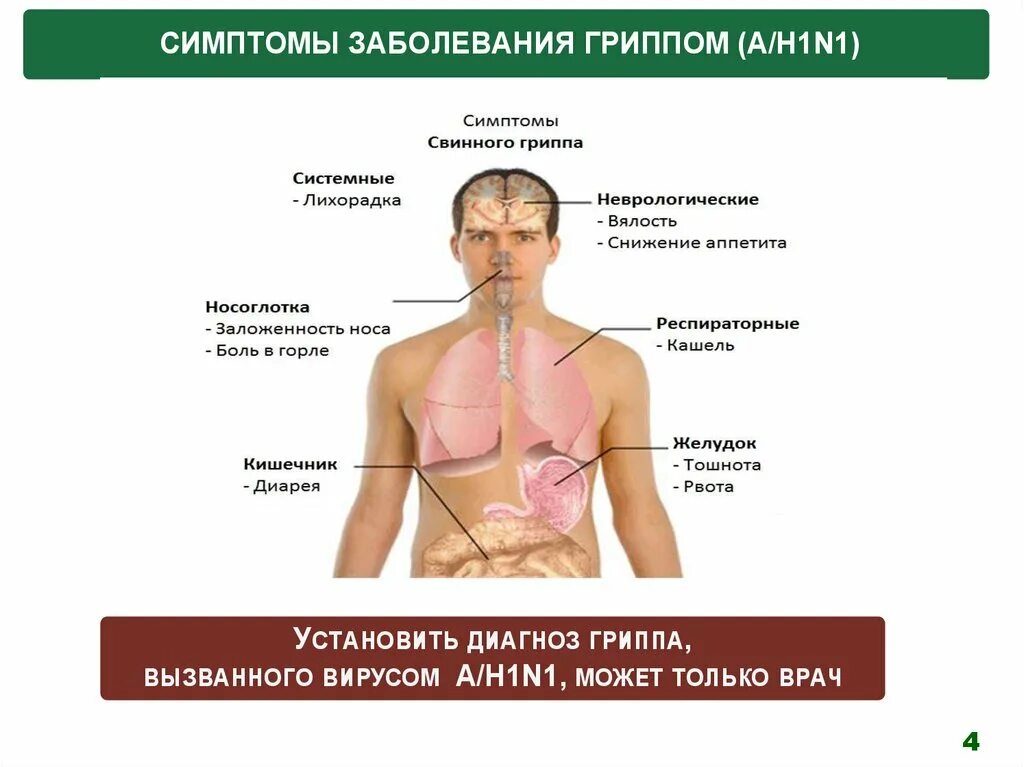 Свиной грипп симптомы. Свиной грипп h1n1 симптомы. Свиной грипп симптомы у детей. Симптомы гриппа h1n1 у взрослого.