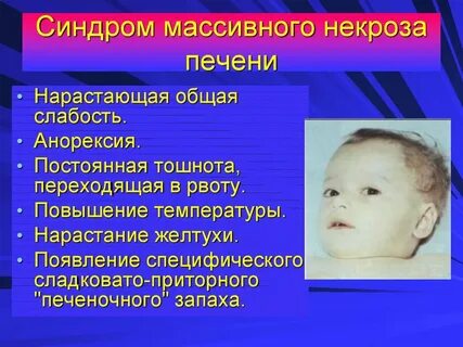 Синдром рвоты новорожденных