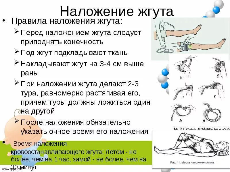 Сколько жжет. Время наложения жнута зимой и лето. Сколько жжет. Наложение жгута при кровотечениях. Сколько жжет.