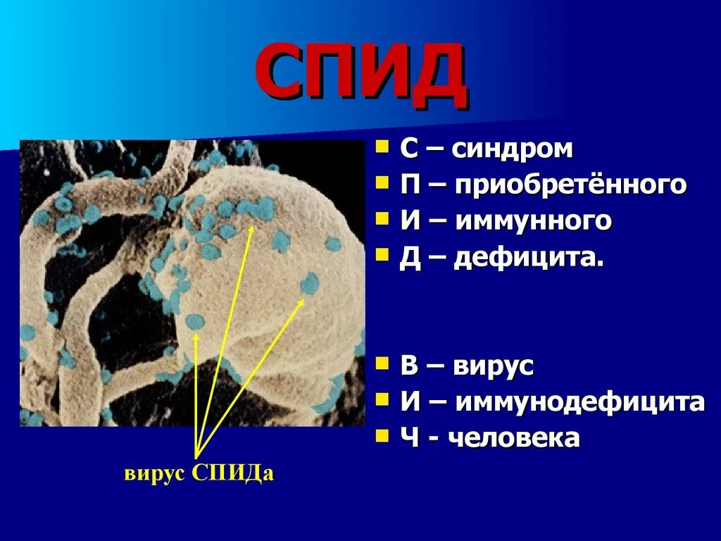 СПИД. ВИЧ СПИД деген эмне. Спид биология 8 класс