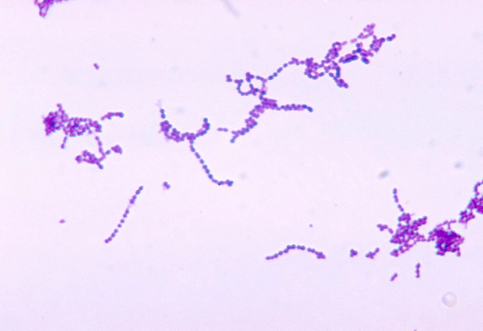 Стафилококк spp. Streptococcus spp. Streptococcus spp под микроскопом. Днк стрептококк spp положительный. Стрептококк серебристый что это.