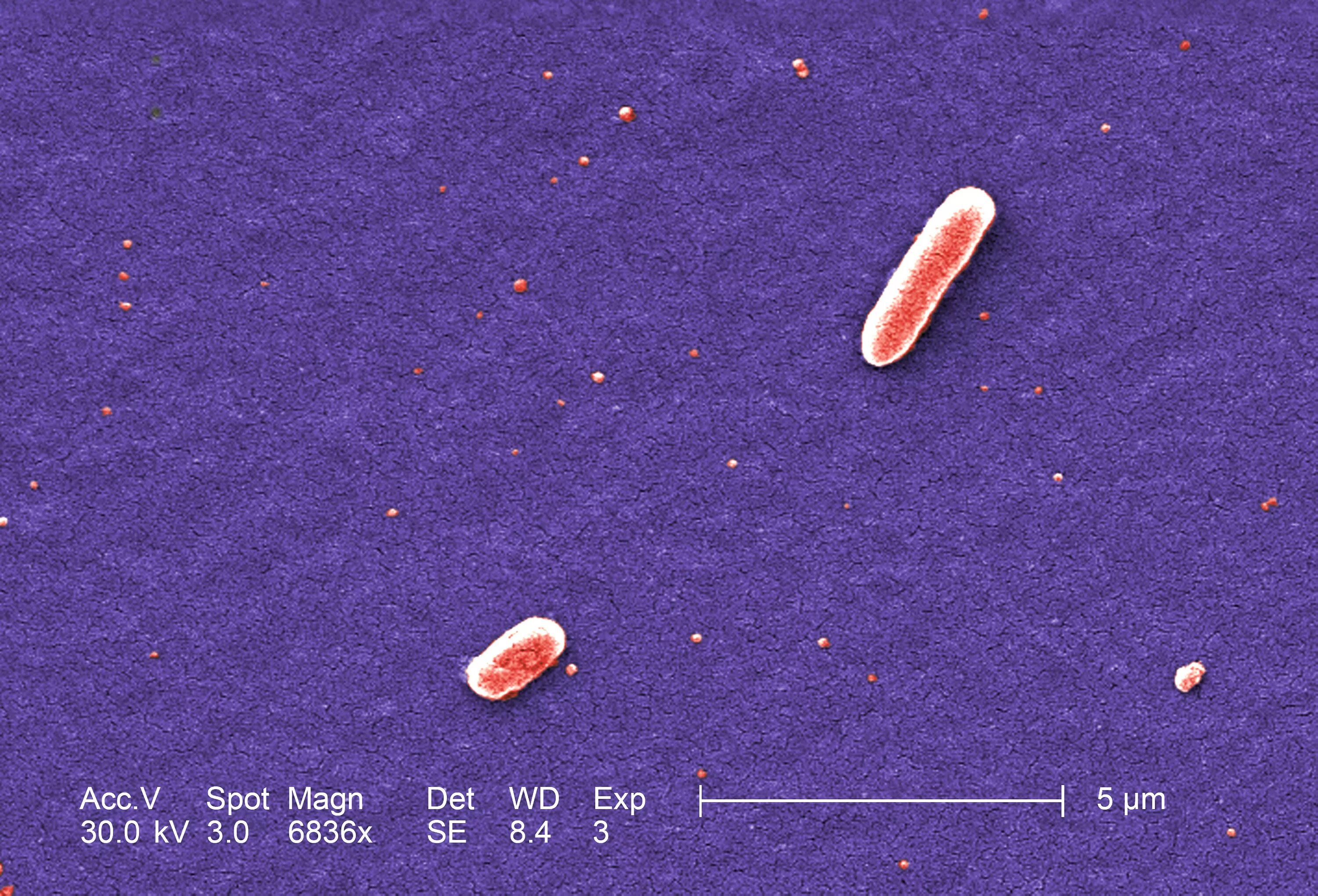 E coli размер. Кишечная палочка размер. бактериофаг эшерихия коли. эшерихии фото. escherichia coli электронная микроскопия.