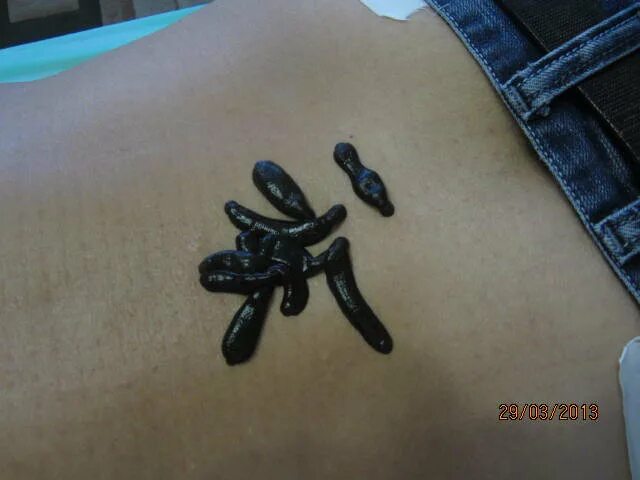 Медицинская пиявка препарат. Продает аптека пиявки. Аптека пиявки спб. Товарные знаки медицинских клиник. Аптека пиявки спб.