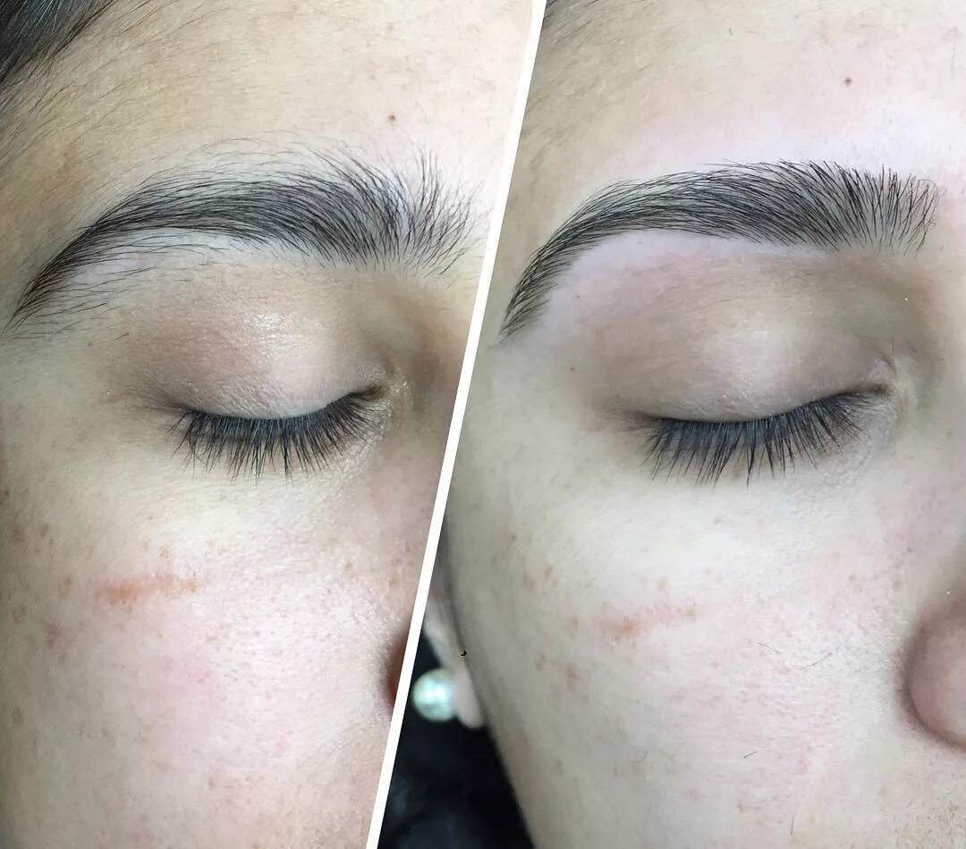 брови после выщипывания