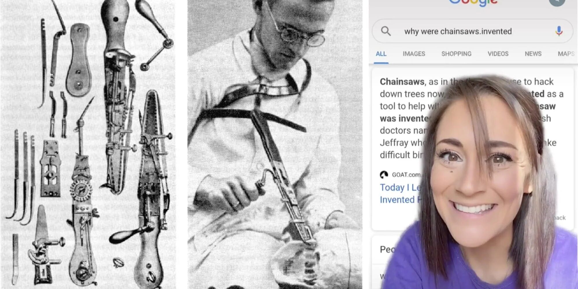 Why do chainsaws was invented. Chainsaw invented. Why do chainsaws was invented. 1st chainsaw 1926. Остеотом гейне.