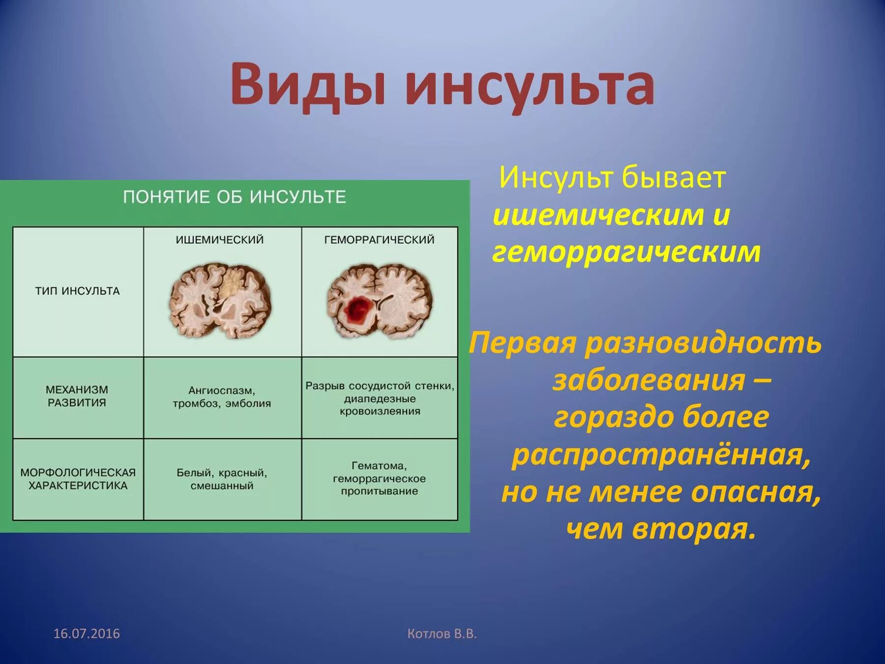 Инсульт 2 степени. Виды инсульта. Типы ишемического инсульта. Виды геморрагического инсульта. Формы инсульта головного мозга.