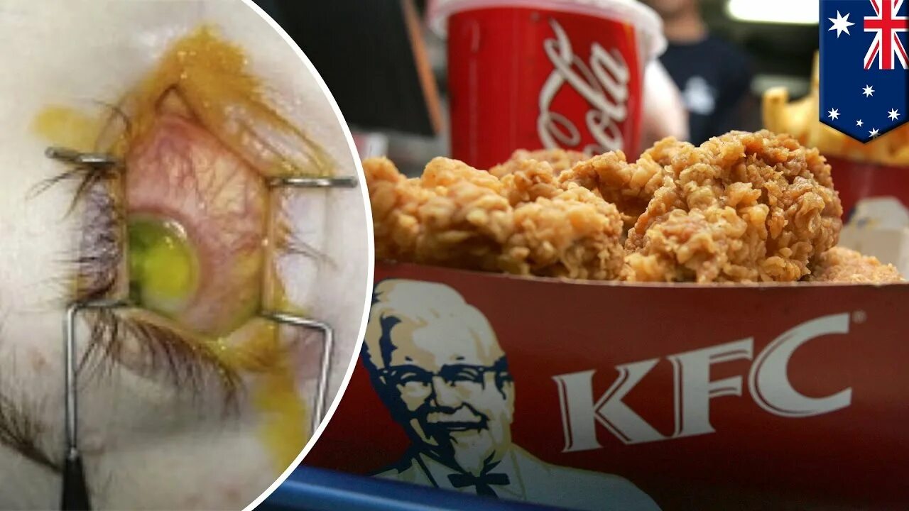 Как расшифровывается kfc. Kfc расшифровывается. аббревиатура кфс. ростикс страшный.