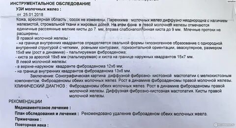 Фиброзно кистозная мастопатия что это молочных желез