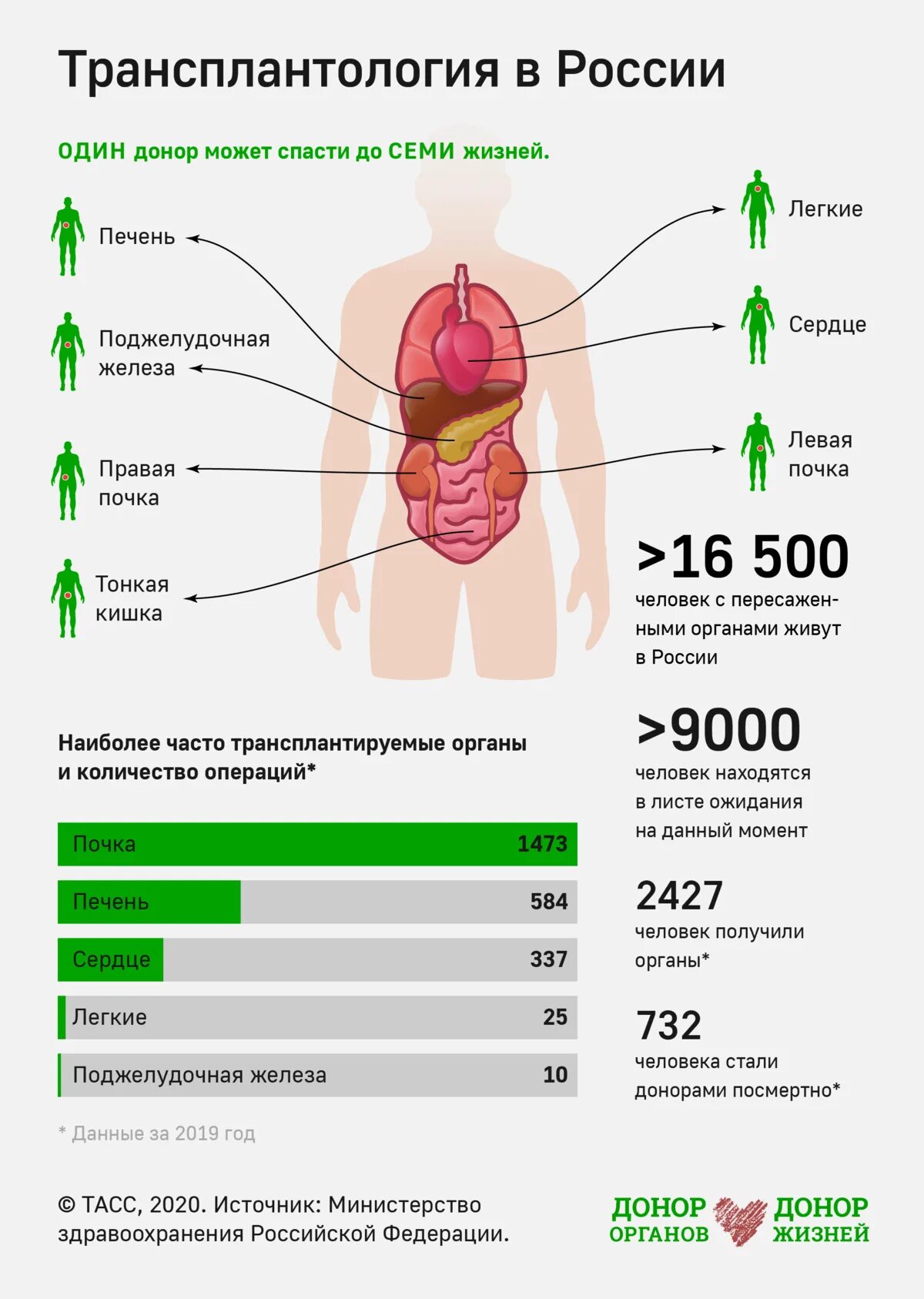 Донор органов в россии