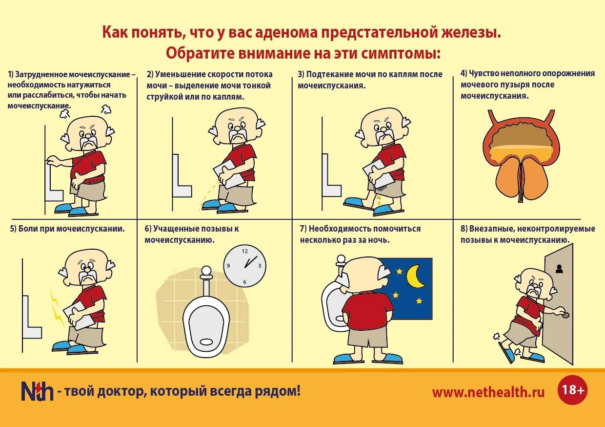 Понять поднимать. Профилактика аденомы простаты. Простата симптомы.