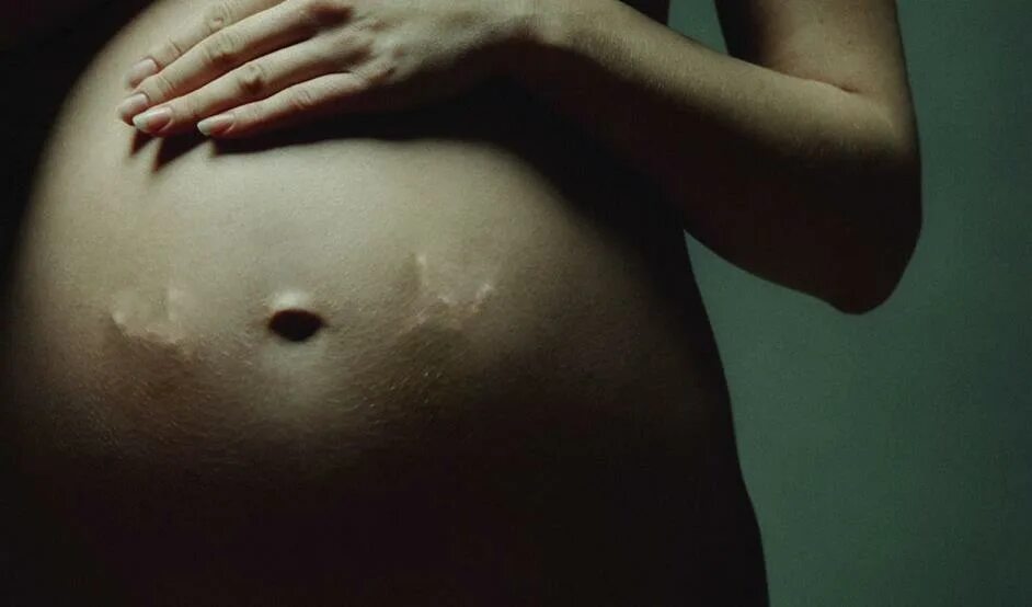 Беременность похоже на первую. Ребёнок толкаеться в животе. Шевеления ребёнка в животе. Ребёнок пинается в жиаоте.