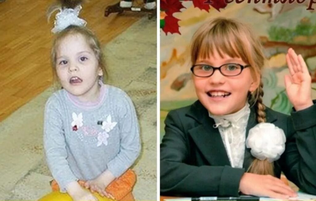 Дети до и после детдома. Ребенок до и после. Усыновленные дети до и после. Фото детей в детском доме и после усыновления.