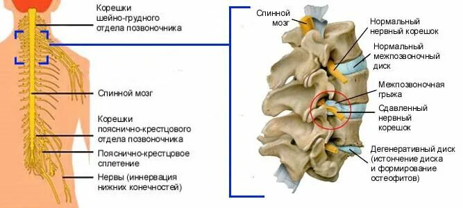 Радикулит грулного отдела поза. Поражение нервных Корешков поясничного отдела позвоночника. Радикулит грудного отдела позвоночника. Радикулопатия пояснично грудной отдел. Лечение защемления нерва в грудном отделе позвоночника