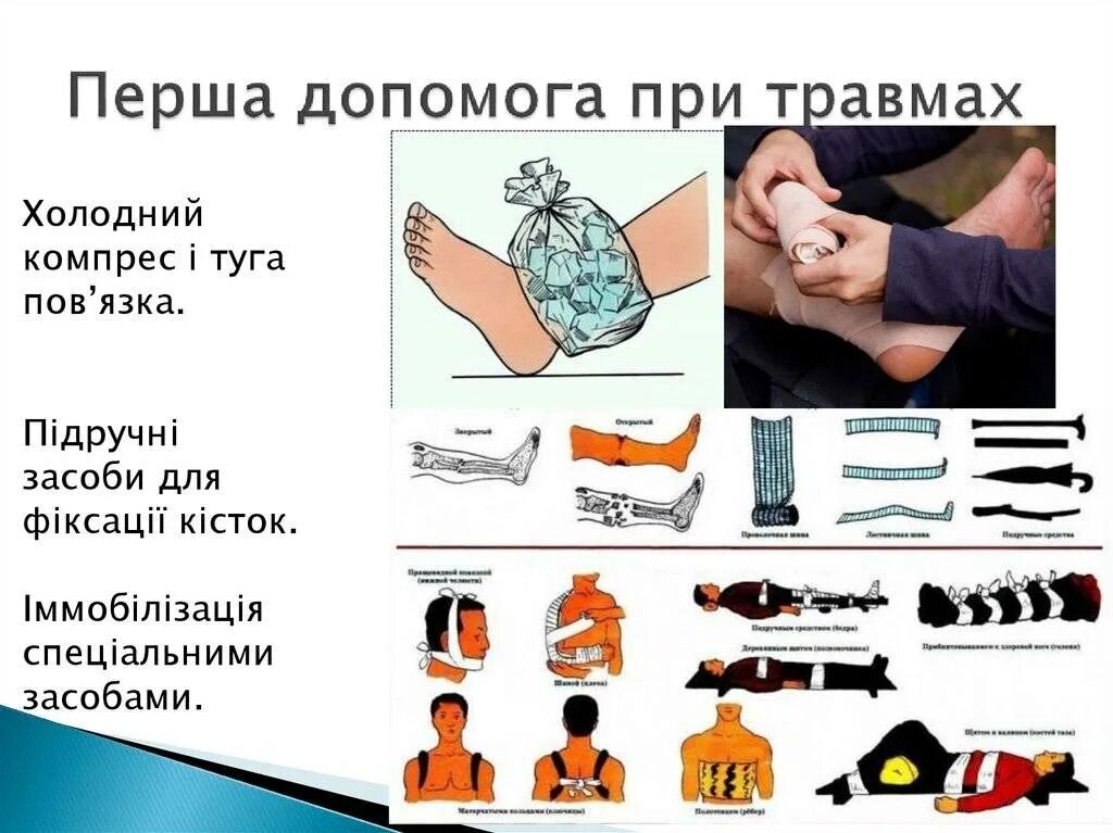 Реферат оказание первой помощи при травмах. Оказание первой помощи при травмах. Оказание первой помощи при травмах и ушибах. Оказание первой помощи при травматизме. Оказание первой помощи при ранениях травмах и повреждениях.