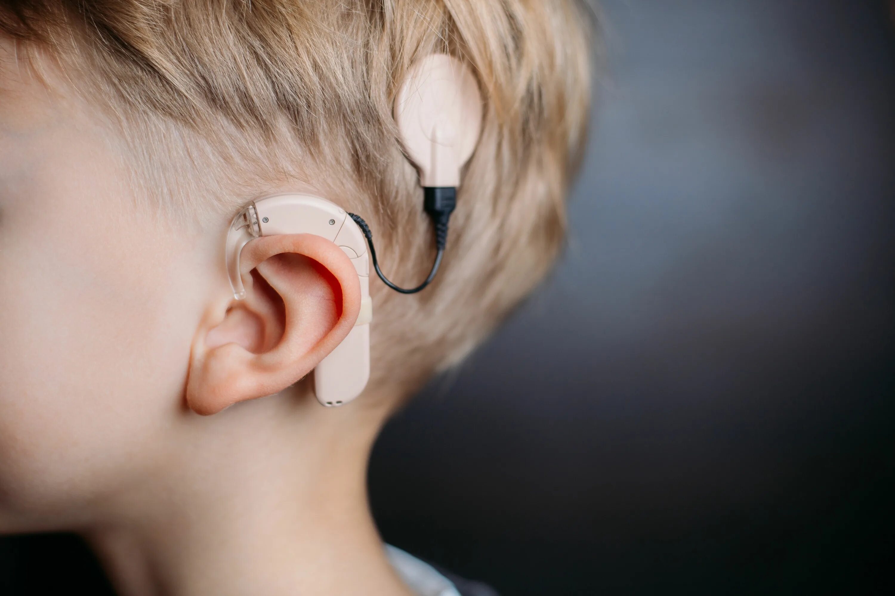 Слуховой аппарат для слабослышащих. Аппарат Cochlear кохлеарный Cochlear. Medel кохлеарный имплант. Слуховой аппарат кохлеарный имплант. Слуховые импланты Кохлер.