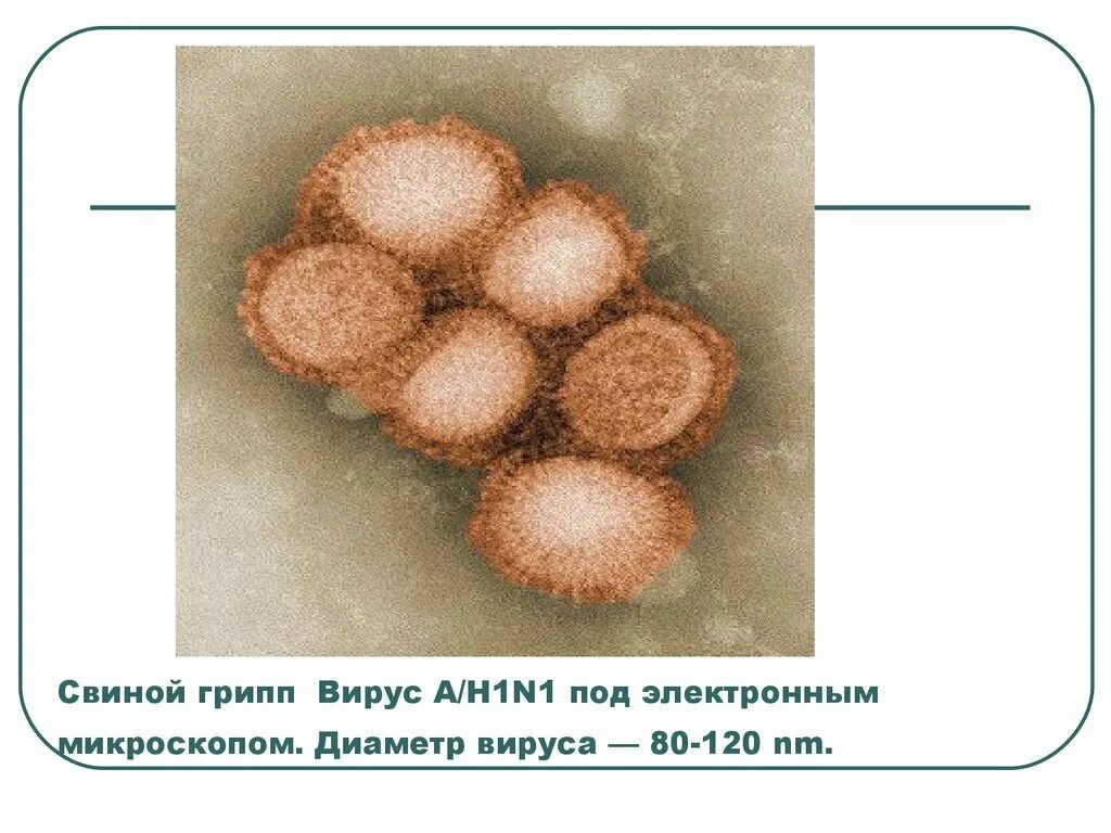 Свиной грипп. Вирус свиного гриппа. Свиной грипп возбудитель. Вирусы под микроскопом. Грипп номер 1