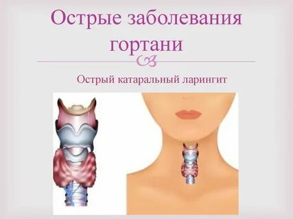 Заболевание гортани лечение