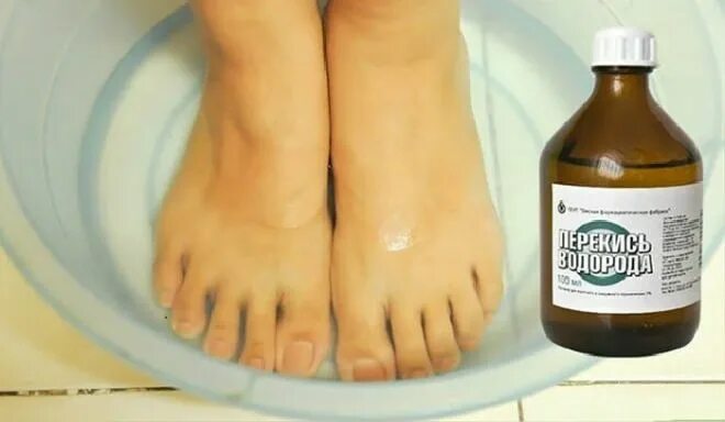 Qué y cómo tratar hongos en las uñas de los pies en su casa en un adulto
