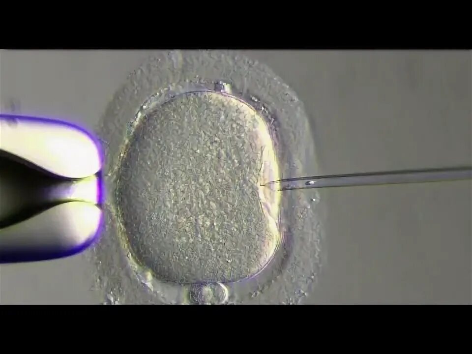 Novedades Donacion de esperma Almeria Mayo - YouTube